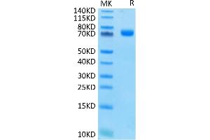 CD33 Protein (CD33) (AA 18-259) (Fc Tag)