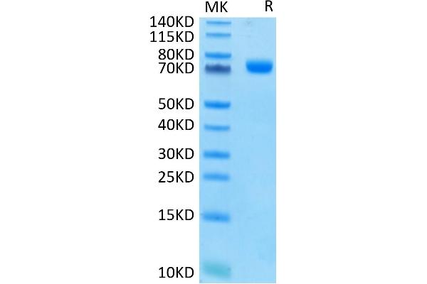 CD33 Protein (CD33) (AA 18-259) (Fc Tag)