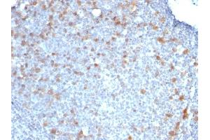 Formalin-fixed, paraffin-embedded human Tonsil stained with CDC20 Monoclonal Antibody (CDC20/1102) (CDC20 antibody)