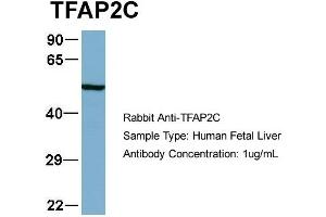 Host:  Rabbit  Target Name:  TFAP2C  Sample Type:  Human Fetal Liver  Antibody Dilution:  1. (TFAP2C antibody  (N-Term))