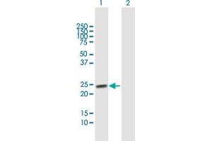 Western Blot analysis of TSPYL4 expression in transfected 293T cell line by TSPYL4 MaxPab polyclonal antibody. (TSPY-Like 4 antibody  (AA 1-211))
