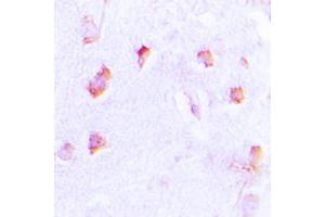 Immunohistochemical analysis of Collagen 20 alpha 1 staining in human brain formalin fixed paraffin embedded tissue section.