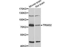 Western blot analysis of extracts of various cell lines, using TRIM32 antibody (ABIN5975475) at 1/1000 dilution. (TRIM32 antibody)