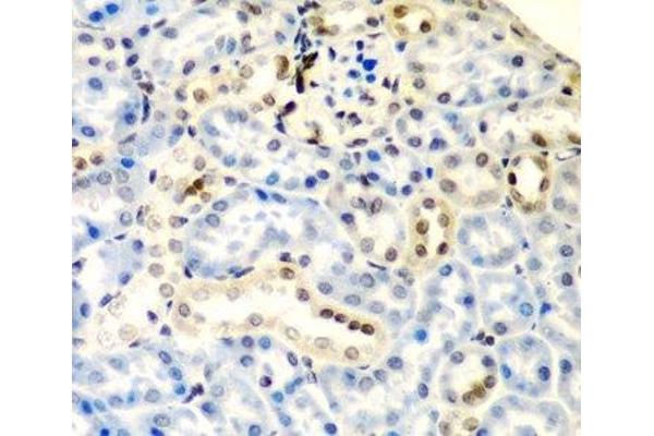 DCMP Deaminase (DCTD) antibody