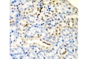 Immunohistochemistry of paraffin-embedded Mouse kidney using DCTD Polyclonal Antibody at dilution of 1:200 (40x lens). (DCMP Deaminase (DCTD) antibody)