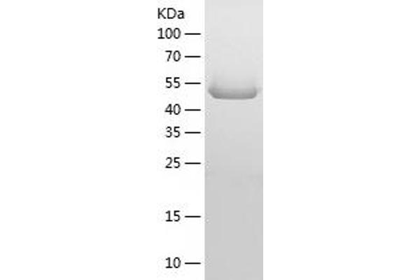 MMP14 Protein (AA 1-501) (His tag)