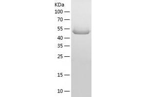 Western Blotting (WB) image for Matrix Metallopeptidase 14 (Membrane-inserted) (MMP14) (AA 1-501) protein (His tag) (ABIN7286351) (MMP14 Protein (AA 1-501) (His tag))