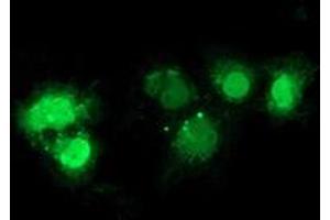 Anti-NHEJ1 mouse monoclonal antibody (ABIN2453927) immunofluorescent staining of COS7 cells transiently transfected by pCMV6-ENTRY NHEJ1 (RC203393). (NHEJ1 antibody)