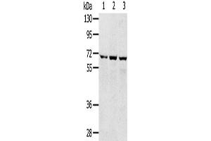 Western Blotting (WB) image for anti-Solute Carrier Family 5 (Sodium/glucose Cotransporter), Member 9 (SLC5A9) antibody (ABIN2427251) (SLC5A9 antibody)