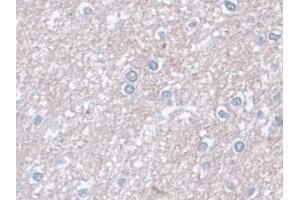 Detection of AST in Human Cerebrum Tissue using Monoclonal Antibody to Aspartate Aminotransferase (AST)