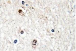 Image no. 1 for anti-NGFI-A Binding Protein 2 (EGR1 Binding Protein 2) (NAB2) antibody (ABIN317614) (NAB2 antibody)