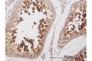 Immunoperoxidase of purified MaxPab antibody to YBX2 on formalin-fixed paraffin-embedded human testis. (YBX2 antibody  (AA 1-364))