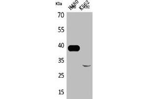 Western Blot analysis of H460 K562 cells using Cathepsin L Polyclonal Antibody