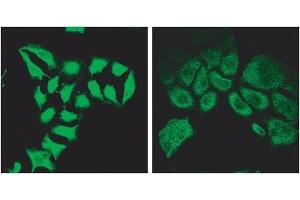 ABIN570717 (2µg/ml) staining of methanol-fixed HeLa before (left) and after (right) introduction of siRNA. (Spartin (SPART) (Internal Region) antibody)