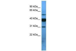 OR2T1 antibody used at 0. (OR2T1 antibody  (C-Term))
