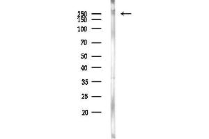 Western blot analysis of lysates from Rat liver, using CACNB Antibody at 1/1000 dilution.