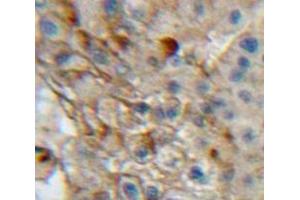 #VALUE! (Integrin alpha 1 antibody  (AA 125-366))