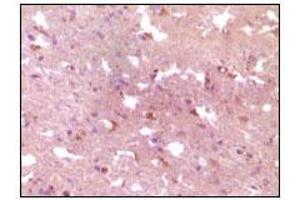Immunohistochemical analysis of paraffin-embedded human Alzheimer brain tissue, showing cytoplasmic localization using APP mouse mAb with DAB staining. (APP antibody)