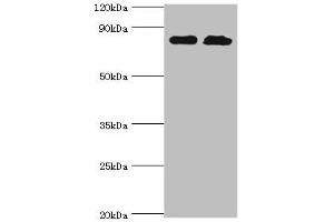 Western blot All lanes: Glutamine--tRNA ligase antibody at 2 μg/mL Lane 1: PC-3 whole cell lysate Lane 2: Hela whole cell lysate Secondary Goat polyclonal to rabbit IgG at 1/10000 dilution Predicted band size: 88, 87 kDa Observed band size: 88 kDa (QARS antibody  (AA 1-250))