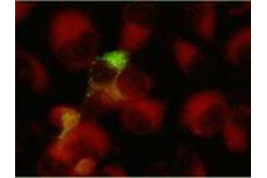 Immunofluorescence (IF) image for anti-Herpes Simplex Virus Type 1, Glycoprotein G (HSV1 gG) antibody (ABIN265554) (HSV1 gG antibody)
