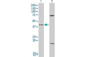 Western Blot analysis of SFRP4 expression in transfected 293T cell line by SFRP4 polyclonal antibody (A01).