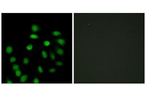 Immunofluorescence analysis of HepG2 cells, using SCAND1 antibody. (SCAND1 antibody  (Internal Region))