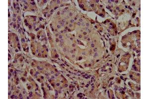 Cholesterol Esterase antibody  (AA 661-753)
