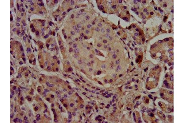 Cholesterol Esterase antibody  (AA 661-753)