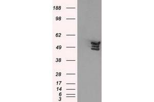 Western Blotting (WB) image for anti-Annexin A11 (ANXA11) antibody (ABIN1496647) (Annexin A11 antibody)