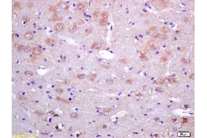 Formalin-fixed and paraffin embedded rat brain tissue labeled with RABBIT ANTI-SAHH POLYCLONAL ANTIBODY, Unconjugated (ABIN708611) at 1:200 followed by conjugation to the secondary antibody and DAB staining. (AHCY antibody  (AA 25-125))