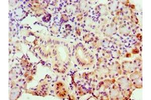 Immunohistochemistry of paraffin-embedded human pancreatic tissue using ABIN7143157 at dilution of 1:100 (ASCC3 antibody  (AA 1-111))