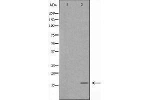 Western blot analysis of TOMM20 expression in K562 cells,The lane on the left is treated with the antigen-specific peptide. (TOMM20 antibody  (Internal Region))