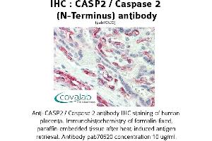 Image no. 1 for anti-Caspase 2, Apoptosis-Related Cysteine Peptidase (CASP2) antibody (ABIN1732648) (Caspase 2 antibody)