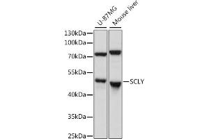 Western blot analysis of extracts of various cell lines, using SCLY antibody (ABIN7270191) at 1:1000 dilution. (SCLY antibody  (AA 284-453))