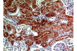 Immunohistochemistry (IHC) image for anti-Drosha, Ribonuclease Type III (DROSHA) (Internal Region) antibody (ABIN7188005)