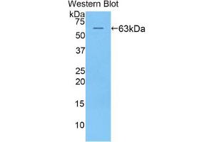 Western blot analysis of the recombinant protein. (KIR2DL2 antibody  (AA 22-348))