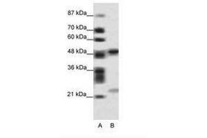 Image no. 1 for anti-PHD Finger Protein 11 (PHF11) (AA 171-220) antibody (ABIN6736092) (PHF11 antibody  (AA 171-220))
