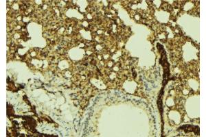 ABIN6269383 at 1/100 staining Mouse lung tissue by IHC-P. (ATRIP antibody  (N-Term))