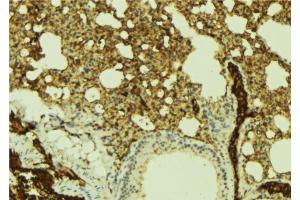ABIN6269383 at 1/100 staining Mouse lung tissue by IHC-P.