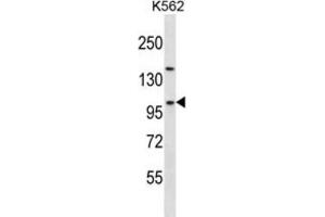 Western Blotting (WB) image for anti-Nucleolar Complex Associated 3 Homolog (NOC3L) antibody (ABIN2997653) (NOC3L antibody)