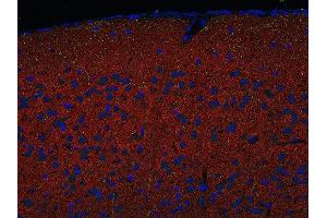 Indirect immunostaining of PFA fixed paraffin embedded mouse cortex section with anti-Homer 1/2/3 (dilution 1 : 500; red) and mouse anti-SERT (green).