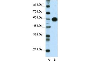 WB Suggested Anti-ZSCAN5 Antibody Titration:  0. (ZSCAN5A antibody  (Middle Region))