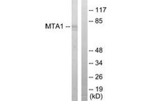 Western blot analysis of extracts from Jurkat cells, using MTA1 Antibody. (MTA1 antibody  (AA 171-220))