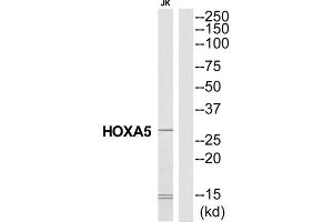 Western Blotting (WB) image for anti-Homeobox A5 (HOXA5) (N-Term) antibody (ABIN1851449) (HOXA5 antibody  (N-Term))