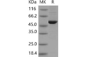 Western Blotting (WB) image for Dopa Decarboxylase (Aromatic L-Amino Acid Decarboxylase) (DDC) protein (His tag) (ABIN7320144) (DDC Protein (His tag))