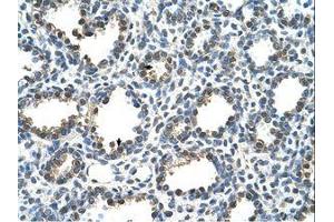 Image no. 1 for anti-RAD23 Homolog A (RAD23A) (AA 141-190) antibody (ABIN203410) (RAD23A antibody  (AA 141-190))