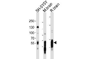 Western Blotting (WB) image for anti-Microtubule-Associated Protein tau (MAPT) (AA 694-728), (C-Term) antibody (ABIN6243259)