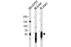 Western blot analysis of lysates from SH-SY5Y cell line, mouse brain, rat brain tissue lysate(from left to right), using PT Antibody (C-term) (ABIN6243259 and ABIN6577758). (MAPT antibody  (C-Term))
