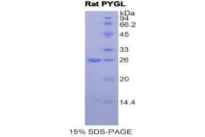 SDS-PAGE (SDS) image for phosphorylase, Glycogen, Liver (PYGL) (AA 73-267) protein (His tag) (ABIN2121145) (PYGL Protein (AA 73-267) (His tag))