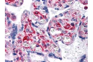 Immunohistochemical analysis of paraffin-embedded human Placenta tissues using VCAM1 mouse mAb (VCAM1 antibody)